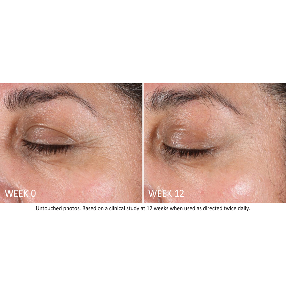 Row4-Image1-BeforeandAfterSerum