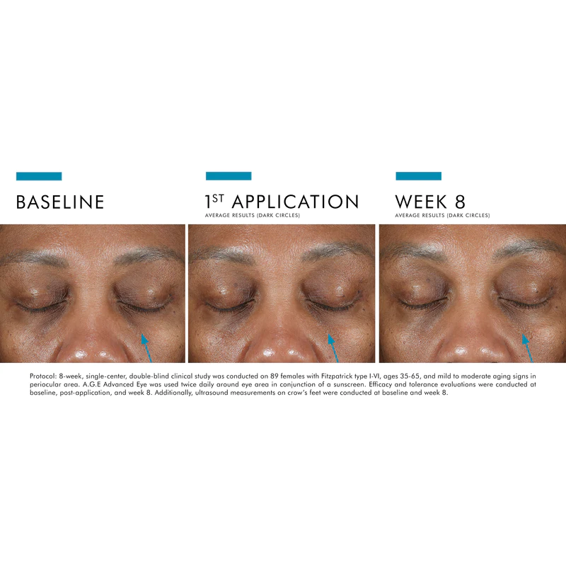 AGEAdvancedEye-Before_After-Model3_800x