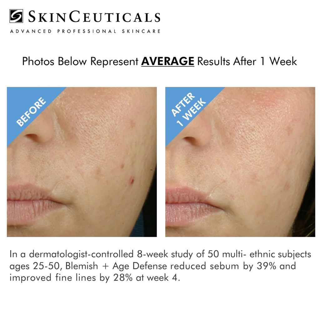 skinceuticals-blemish-age-defense_1024x1024