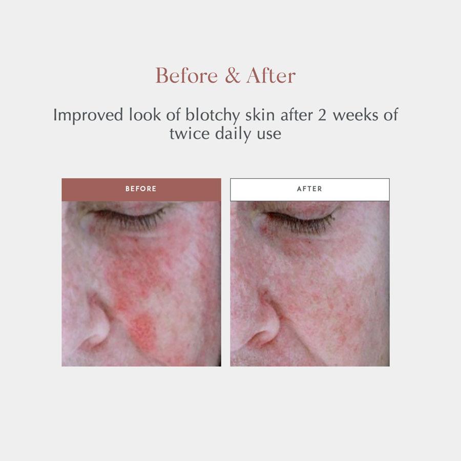 AntiRedness Calming Serum2